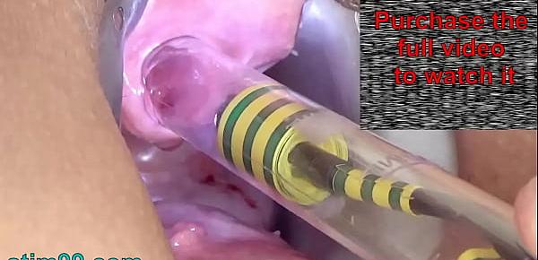  Woman Pee Hole Playing, Urethral Insertion with Endoscope Cam